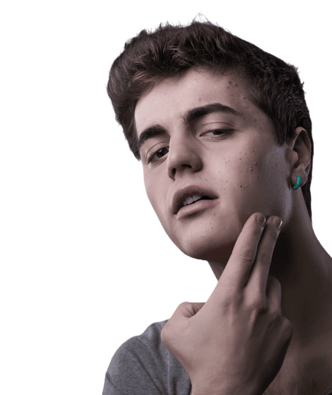 Organic Anti-Acne Facial Moisturizer - FOR MEN-1